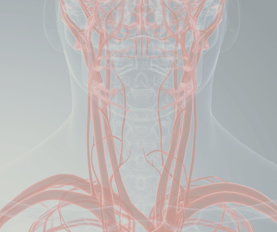 carotid artery screening